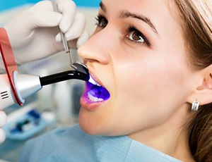 young woman getting dental bonding hardened with curing light 