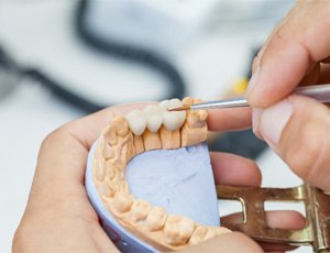Working on a dental bridge in Carrollton, TX on mold of teeth