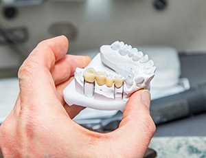 Couple smiling with dental bridge in Carrollton