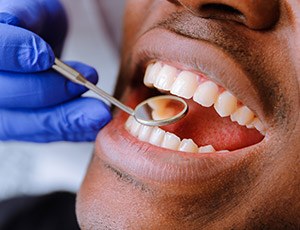 Closeup of smile during dental exam