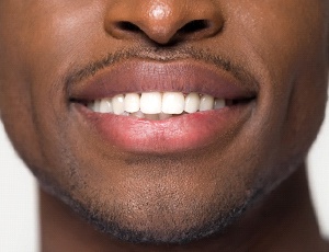 Closeup of a man’s beautiful smile after cosmetic dentistry in Carrollton