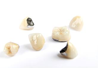 Dental crowns lying on a table