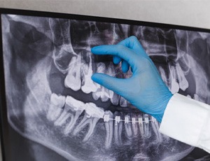 dentist looking at xrays 