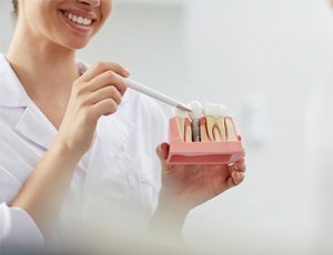 dentist pointing to a model of a dental implant