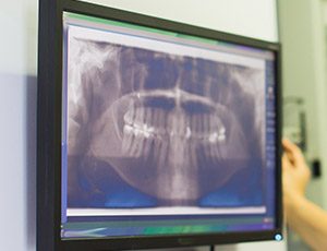 Digital dental x-rays on computer
